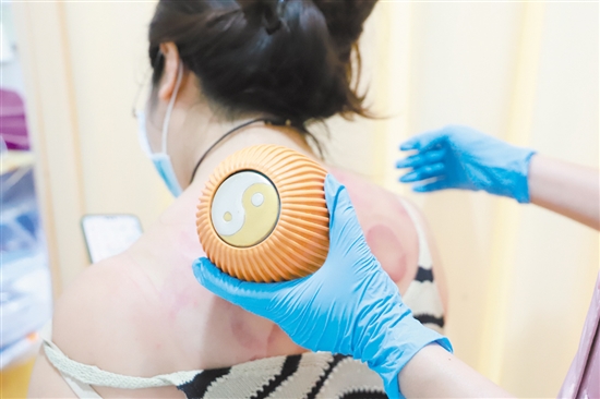 醫(yī)護人員在夜間門診為患者拔火罐。