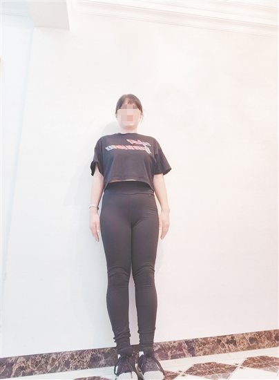 高女士減脂前后對(duì)比。